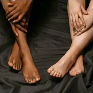 Laser Hair Removal 17 Depilated women's legs