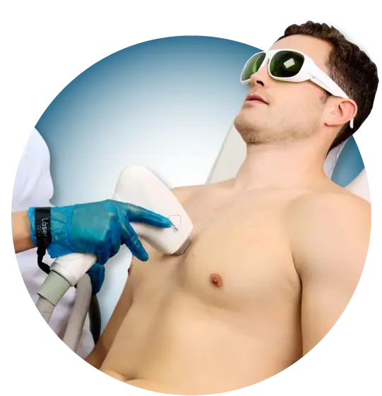 Laser Hair Removal 3 Man applying laser to his chest