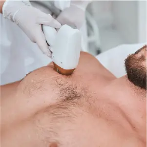 Laser Hair Removal 13 Man waxing his chest
